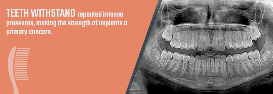 durability of metal plated dental devices